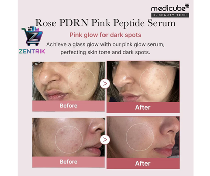 SERUM COREANO DE SALMON MEDICUBE PDRN